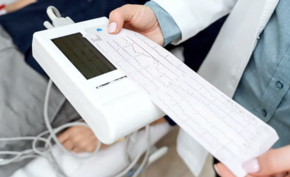 ekg results of a patient 